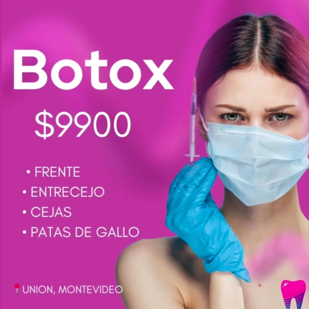 tratamiento botox